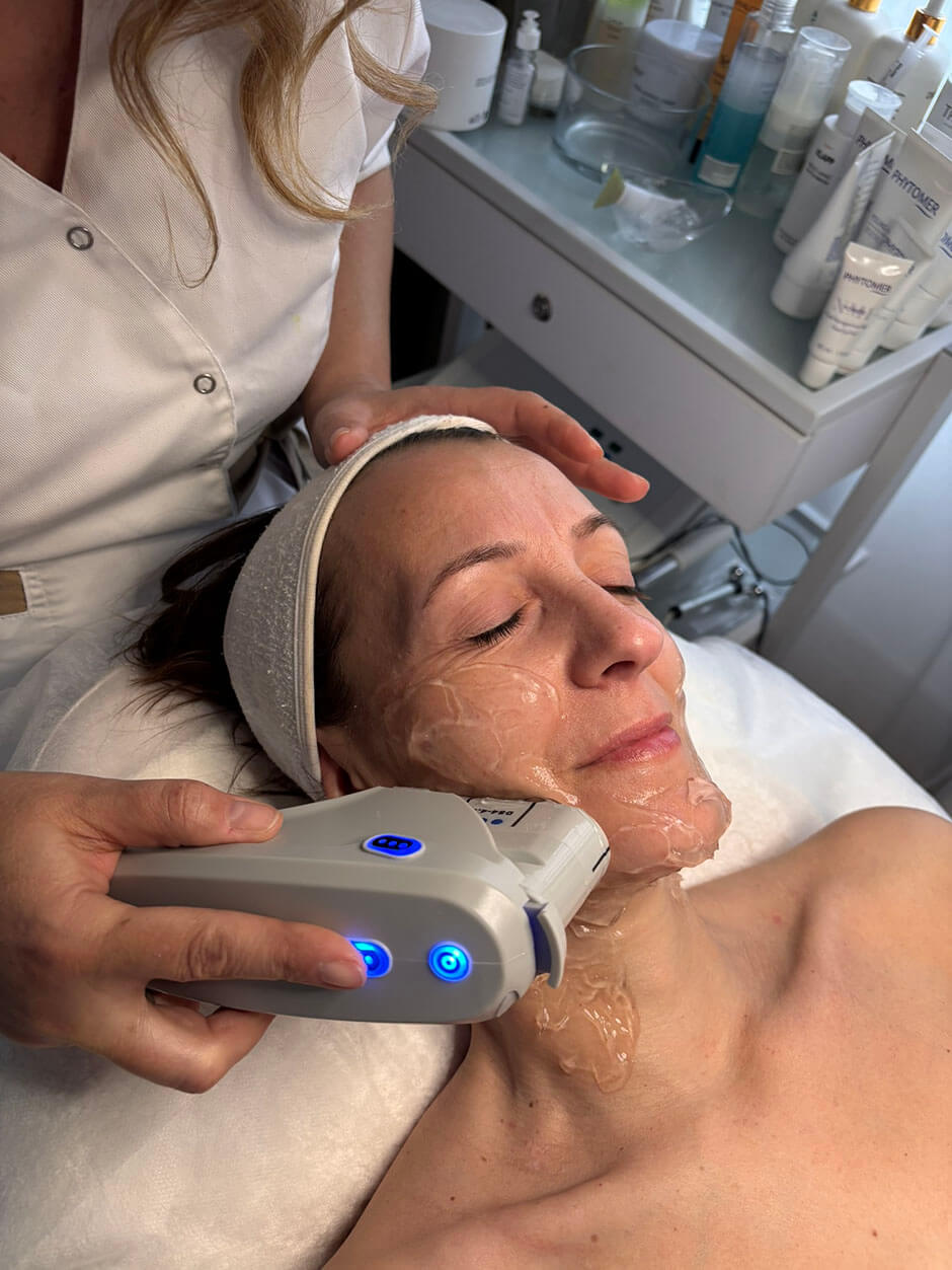 HIFU tretman lica za zatezanje kože u Iva Beauty Labu u Beogradu